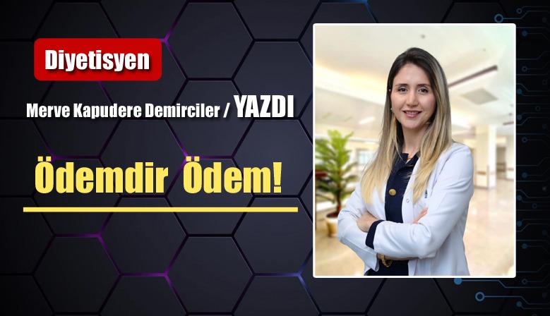Ödemdir Ödem!
